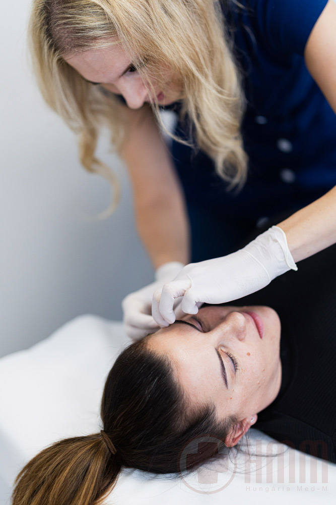 Bioszálas arcfiatalítás